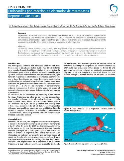 Endocarditis por infecciÃ³n de electrodos de marcapasos ... - SciELO