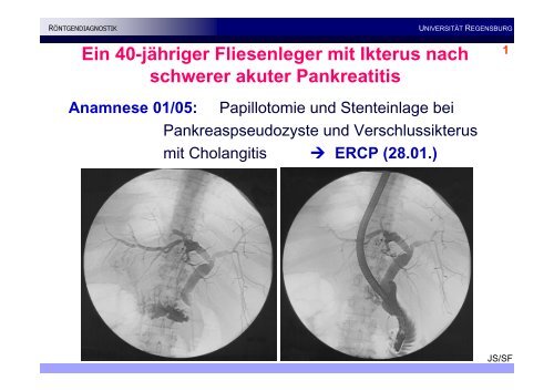 Ein 40-jÃ¤hriger Fliesenleger mit Ikterus nach schwerer ... - DGIM 2010