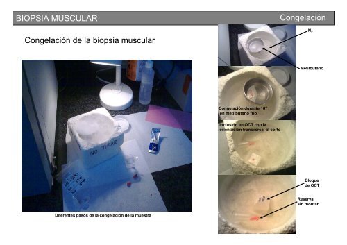 Metodología y técnicas para el estudio de enfermedades musculares