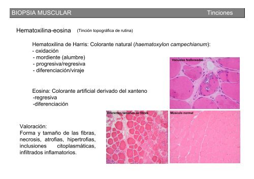 Metodología y técnicas para el estudio de enfermedades musculares