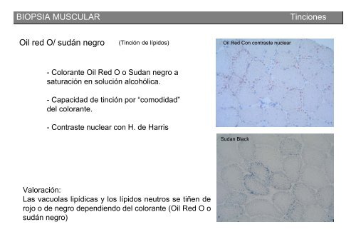 Metodología y técnicas para el estudio de enfermedades musculares