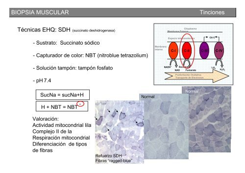 Metodología y técnicas para el estudio de enfermedades musculares