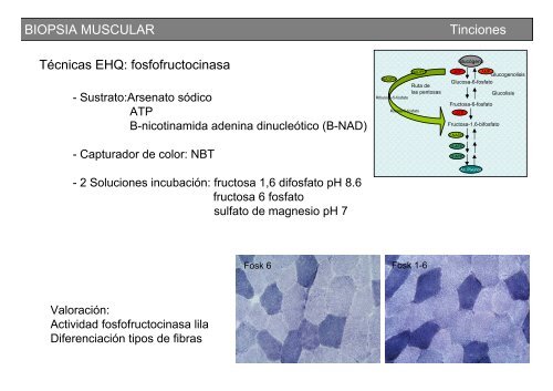 Metodología y técnicas para el estudio de enfermedades musculares