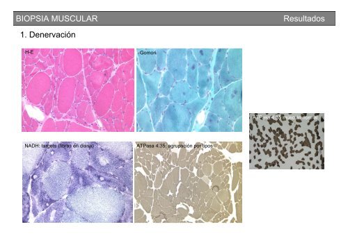 Metodología y técnicas para el estudio de enfermedades musculares