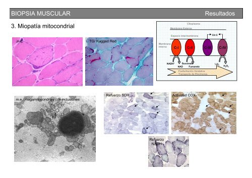 Metodología y técnicas para el estudio de enfermedades musculares