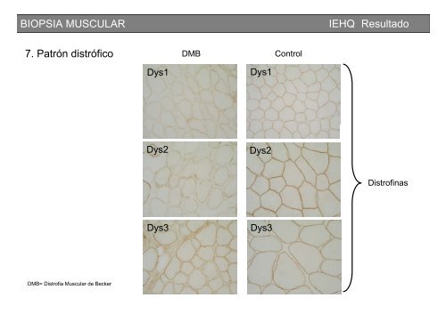 Metodología y técnicas para el estudio de enfermedades musculares