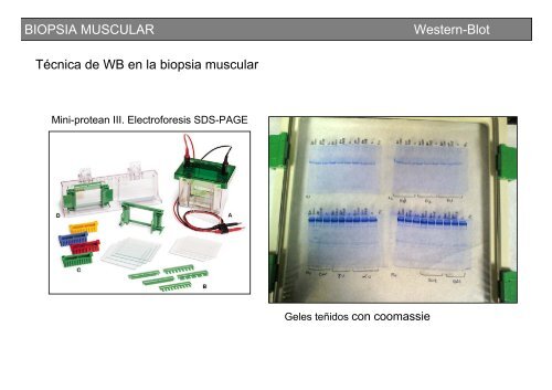 Metodología y técnicas para el estudio de enfermedades musculares