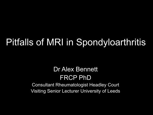 Pitfalls of MRI in Spondyloarthritis