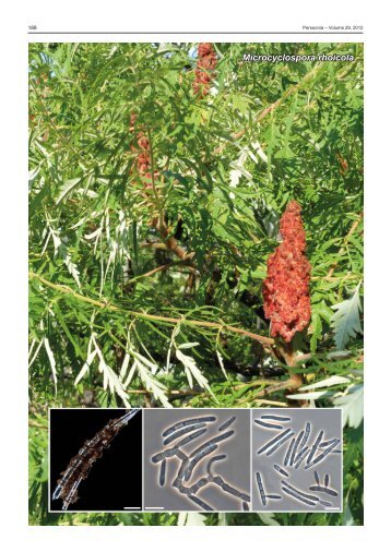 Microcyclospora rhoicola - Fungal Planet