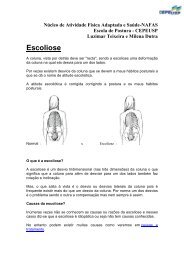 Escoliose - Luzimar Teixeira