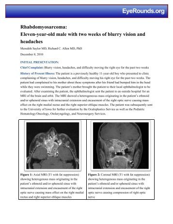 Rhabdomyosarcoma: Eleven-year-old male with two weeks of blurry ...