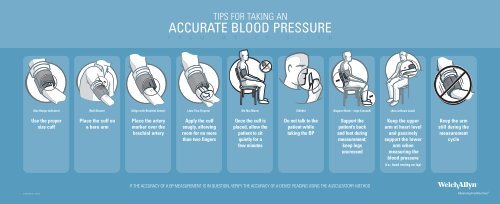 Non Invasive Blood Pressure - Living on the EDge
