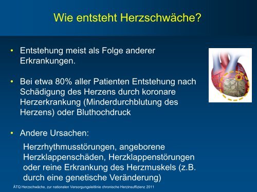 Herzinsuffizienz – Praktisch erklärt