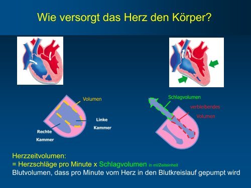 Herzinsuffizienz – Praktisch erklärt