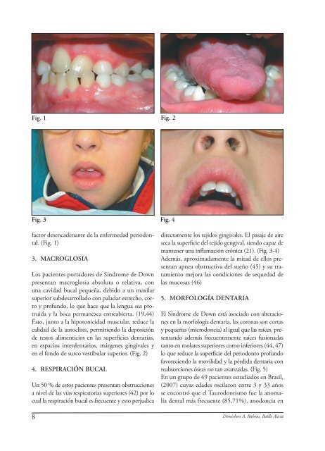 La enfermedad periodontal asociada al paciente con ... - SciELO