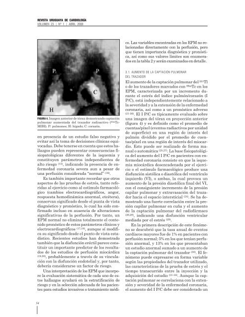 Variables de alto riesgo para cardiopatÃ­a isquÃ©mica ... - SciELO