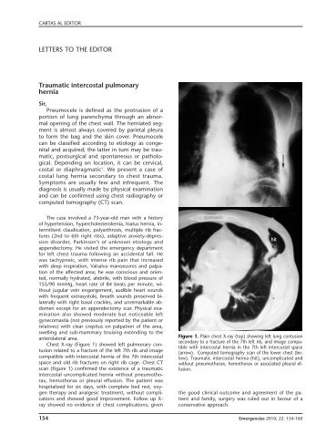 Traumatic Intercostal Pulmonary Hernia - Semes
