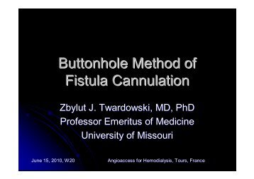 W20b Twardowski 1 Buttonhole Method of Fistula ... - SFAV