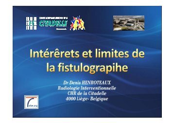 017 IntÃ©rÃªt et limites de la fistulographie Denis ... - SFAV