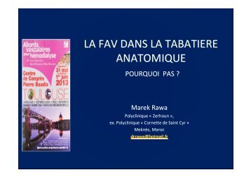 LA FAV RADIALE DANS LA TABATIERE ANATOMIQUE (2 ... - SFAV