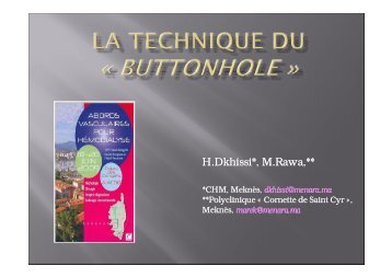41 Rawa Buttonhole.ppt [Lecture seule] - SFAV