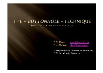 W20a Rawa The Buttonhole technique.ppt [Lecture seule] - SFAV