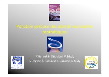 Ponction prÃ©coce des abords vasculaires prothÃ©tiques - SFAV