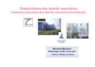 Complications des abords vasculaires - SFAV