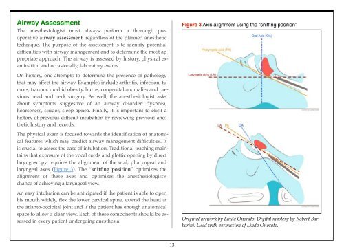 Understanding Anesthesiology - The Global Regional Anesthesia ...