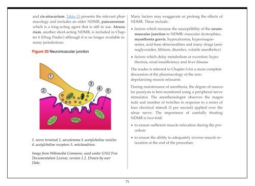 Understanding Anesthesiology - The Global Regional Anesthesia ...