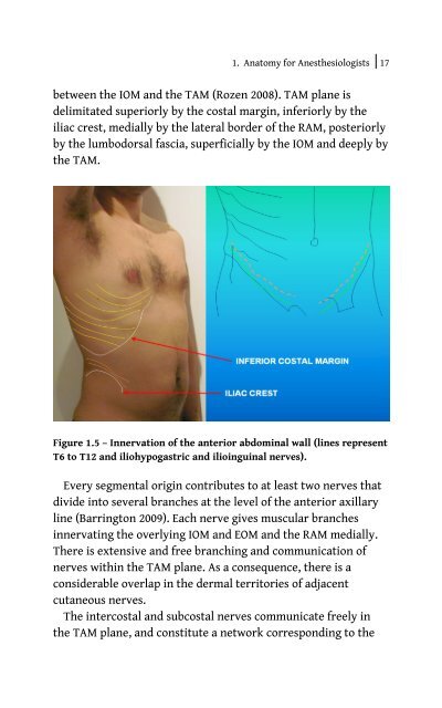 Ultrasound Blocks for the Anterior Abdominal Wall