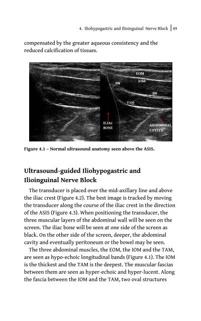 Ultrasound Blocks for the Anterior Abdominal Wall