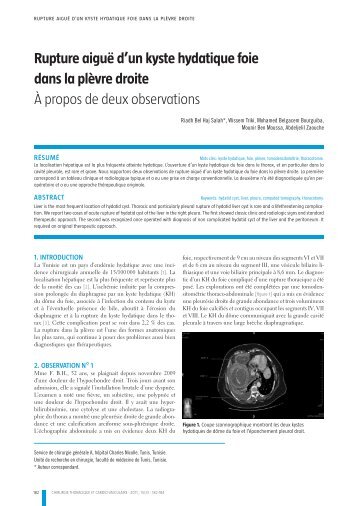 Rupture aiguÃ« d'un kyste hydatique foie dans la plÃ¨vre droite ... - sfctcv