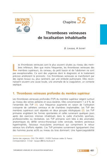 Thromboses veineuses de localisation inhabituelle - SFMU