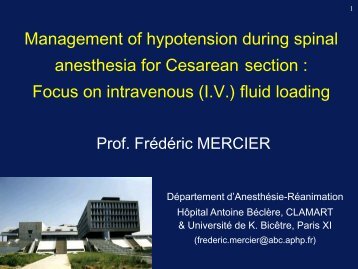 Management of hypotension during SA for CS