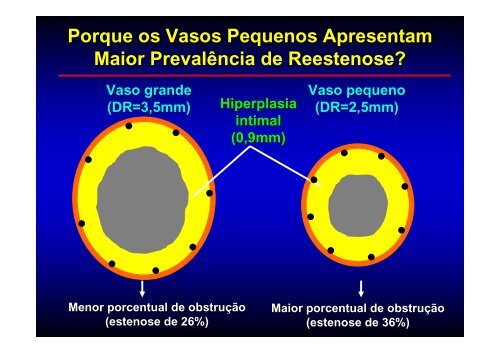 Vasos de Menor Calibre (