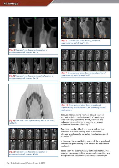 Download e-copy - Smile Dental Journal