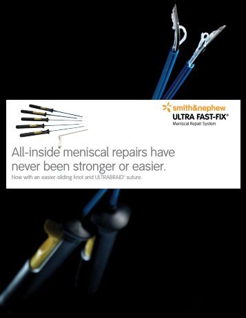 All-inside meniscal repairs have never been stronger or easier.
