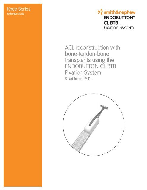 1061504_Rev. A ENDOBUTTON Tech - EUROCIENCIA