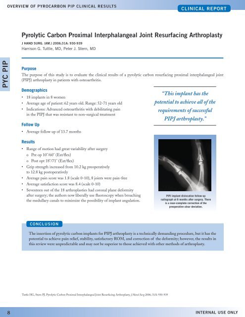 Proximal interphalangeal Joint arthroplasty