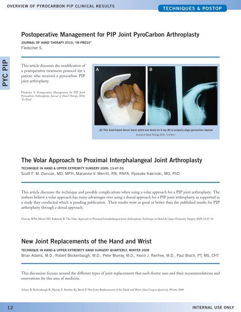 Proximal interphalangeal Joint arthroplasty