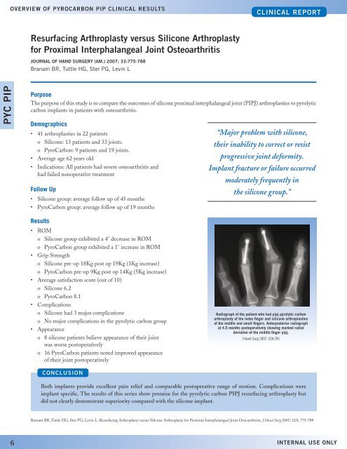 Proximal interphalangeal Joint arthroplasty