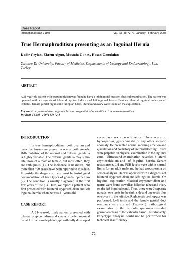 True Hermaphroditism presenting as an Inguinal Hernia - SciELO