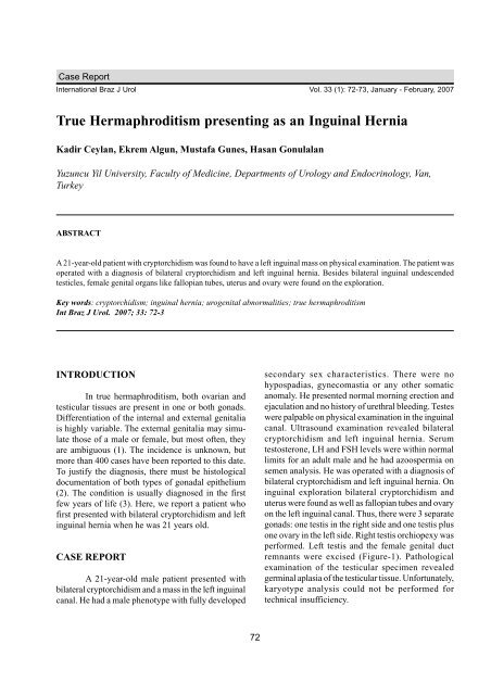 True Hermaphroditism presenting as an Inguinal Hernia - SciELO