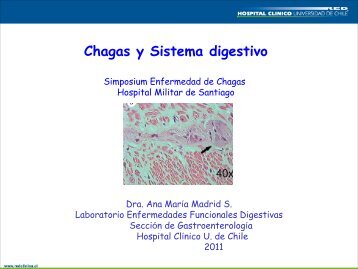 Chagas y Sistema digestivo