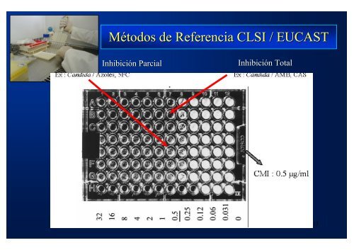 Estudio de susceptibilidad in vitro