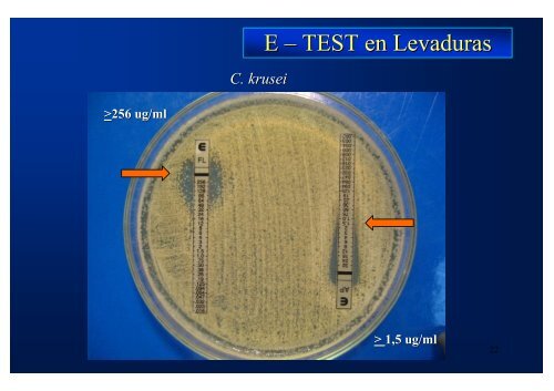 Estudio de susceptibilidad in vitro