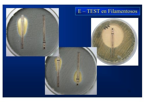 Estudio de susceptibilidad in vitro