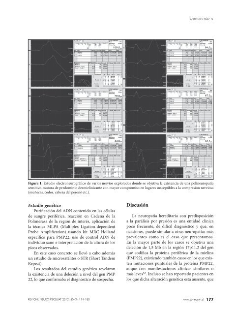 Revista 3-2012 (PDF) - Sonepsyn