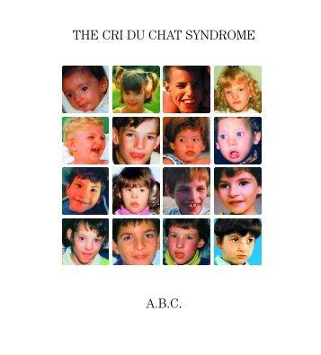 ABC SCDC Book EN - Associazione Bambini Cri Du chat